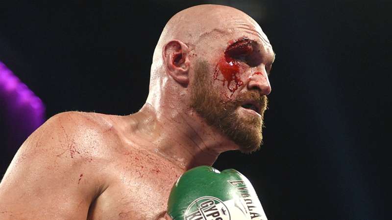 BREAKING: Tyson Fury suffers career ending injury after Usyk defeat.