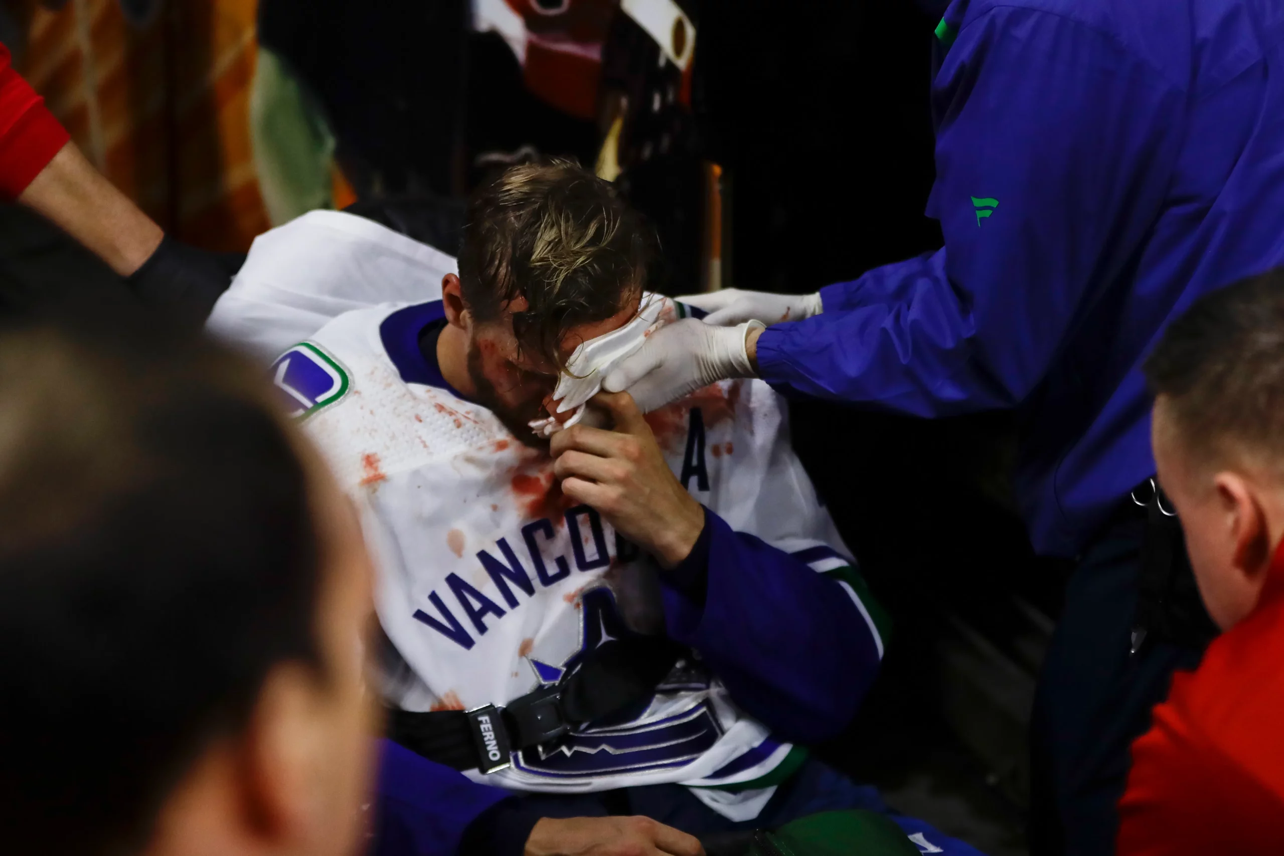 BREAKING: Canucks have lost another top talent to injury.